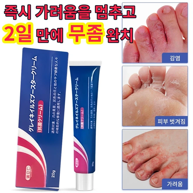 발바닥무좀